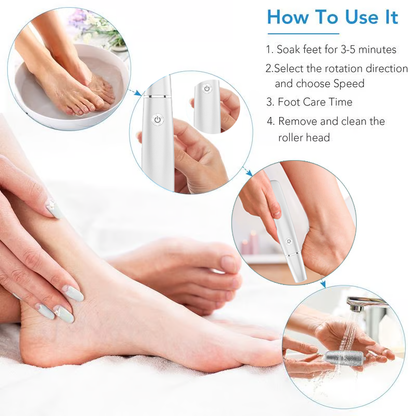 ✨Portable Electric Feet Callus Remover🎁🦶-Navalonixcosh®