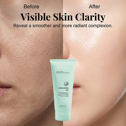 upsell🔥 50K+ SOLD! 🔥  🌿 Herbal Brightening Exfoliating Gel 🌿 ✨ Instantly Smooth & Glow  💖 Gentle Exfoliation 💥 SAVE 40% 💥-Navalonixcosh®