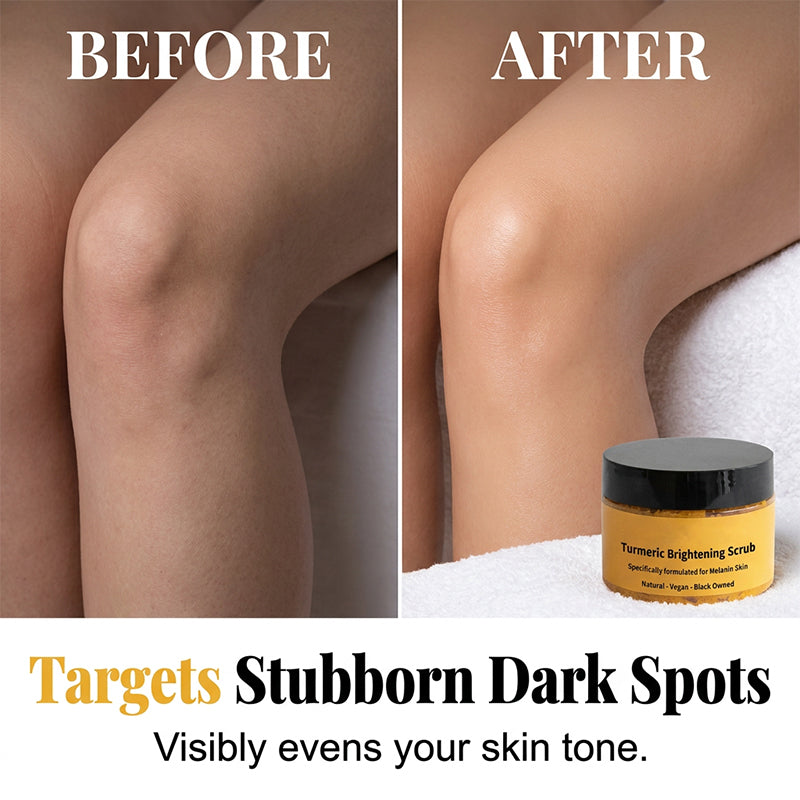 🔥BUY 2 GET 1 FREE🔥Turmeric Exfoliating Body Scrub-Navalonixcosh®
