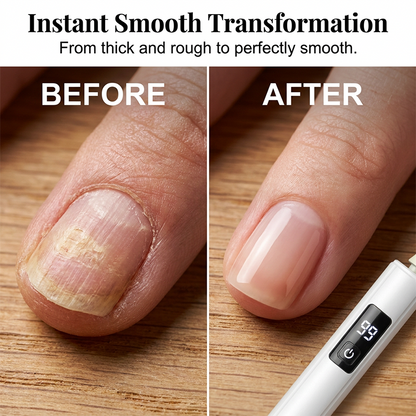 🥳2026 HOT SALE🥳💞50K+ SOLD!💅✨ 50% OFF! Professional Electric Nail Polisher – Smooths thick nails, 99-speed display. Multiple heads for shaping & buffing. Salon at home! 🌟💎-Navalonixcosh®